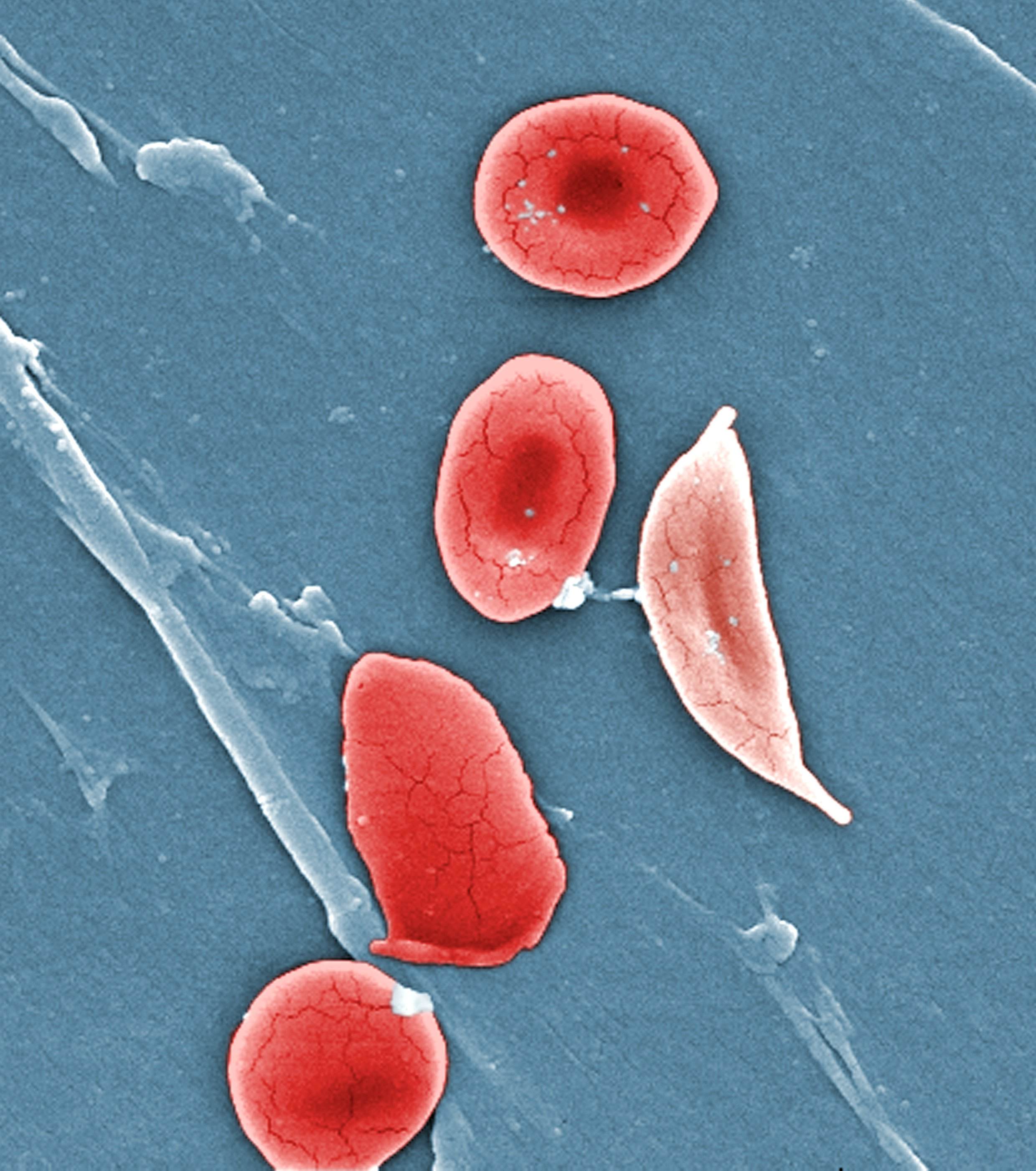 Comparative ultrastructural morphology between normal red blood