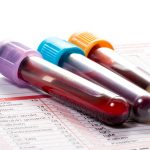 Blood testing tubes