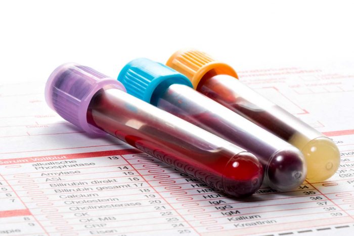 Blood testing tubes