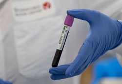 Blood products for research