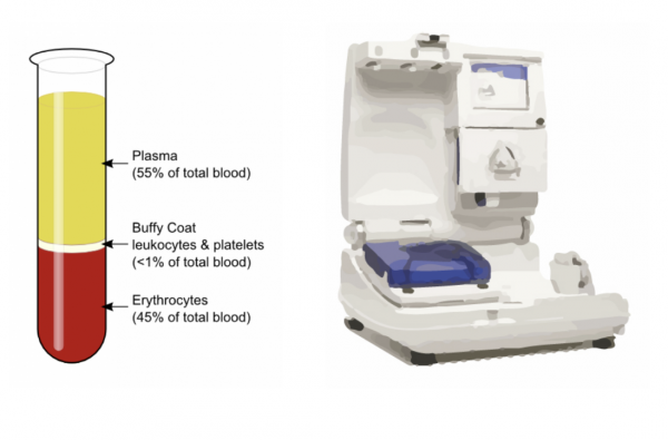 Collecting Plasma on the ALYX Machine — Stanford Blood Center