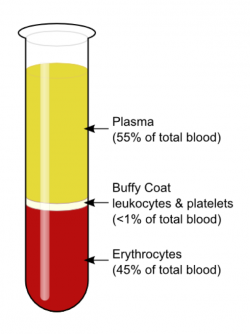 plasma