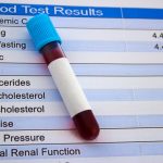 cholesterol test image