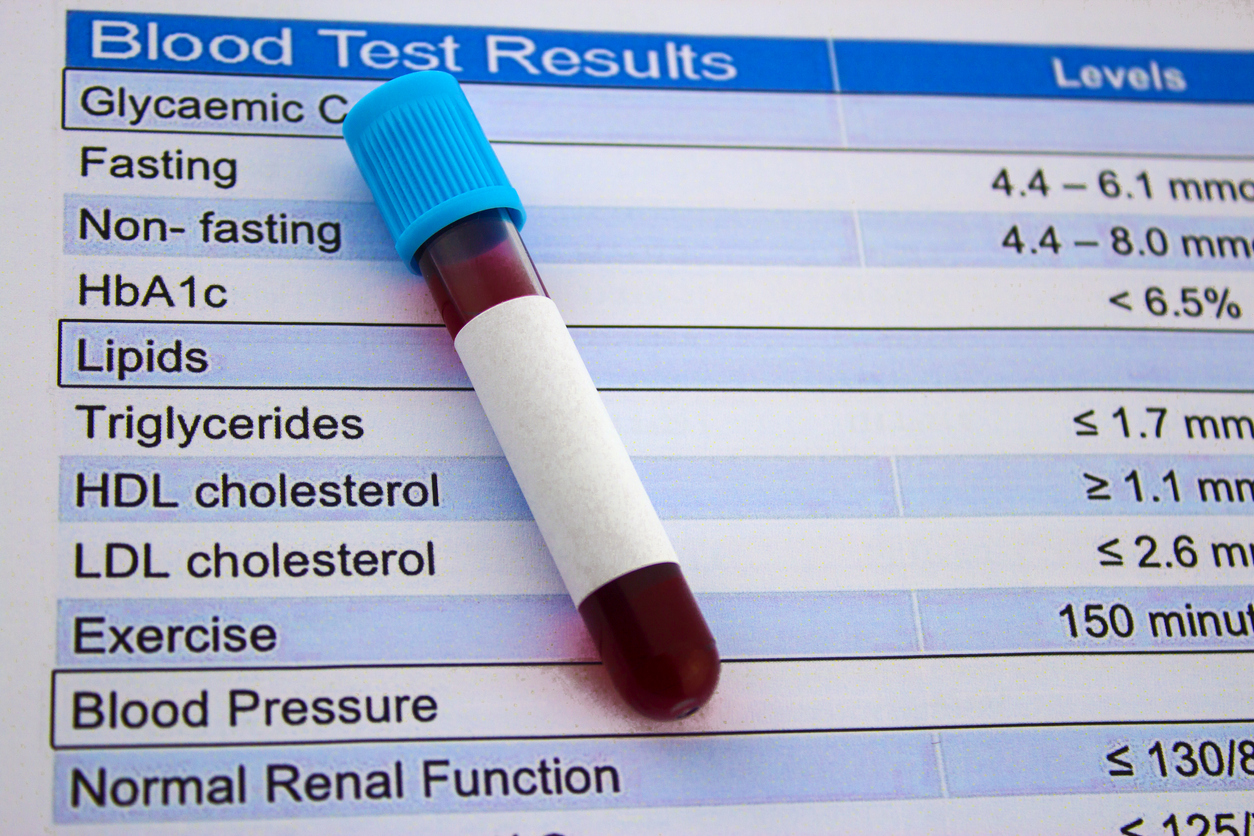 What Does Cholesterol Ratio 2 9 Mean