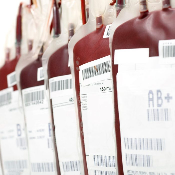 Fresh Whole Blood 475ML (CPD or CP2D, Anti-Coagulant) — Stanford Blood ...