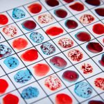 Drops of blood for blood group medical exam concept